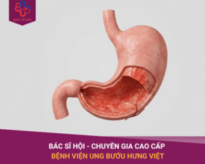 Viêm xung huyết hang vị dạ dày là gì? Có nguy hiểm không?